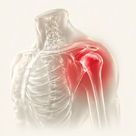 Frozen Shoulder - condition treatment at AvaTrita