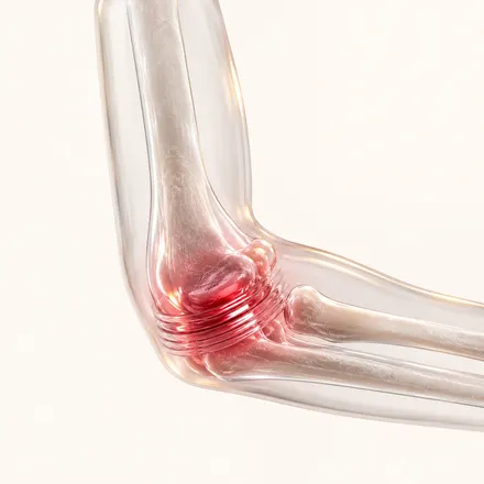 Post-Injury Stiffness - condition treatment at AvaTrita