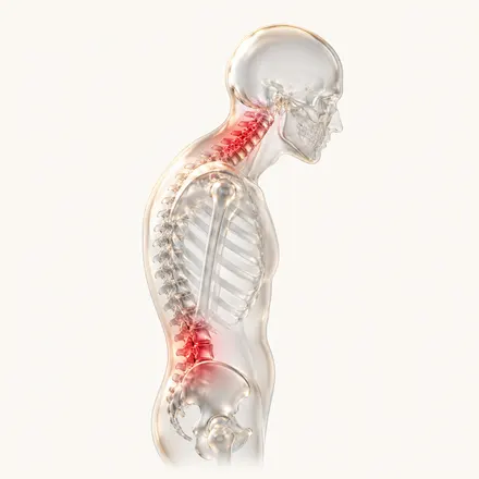 Postural & Movement-Related Pain - condition treatment at AvaTrita