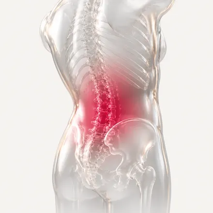Lumbar Conditions - condition treatment at AvaTrita